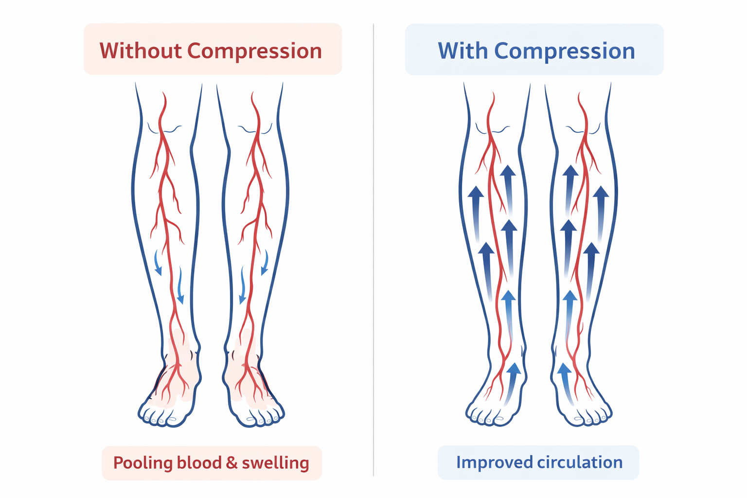 Circulation comparison with and without compression socks